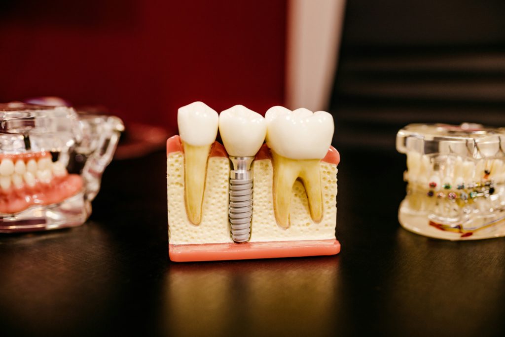 CARCDSF : comment préparer efficacement sa retraite en tant que chirurgien-dentiste ?