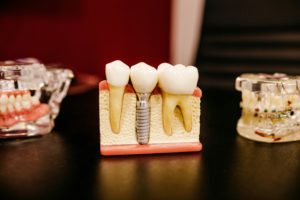 Chirurgien-dentiste préparant sa retraite avec un expert-comptable spécialisé en professions de santé